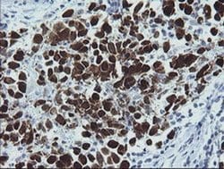 Invitrogen MAGEA4 Monoclonal Antibody (OTI1F9) 100 &mu;L; Unconjugated:Antibodies,