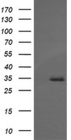 Invitrogen MAGEA4 Monoclonal Antibody (OTI1F9) 100 &mu;L; Unconjugated:Antibodies,