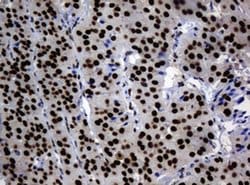 Invitrogen ZNF447 Monoclonal Antibody (OTI4D10) 100 &mu;L | Buy Online | Invitrogen&trade; | Fisher Scientific