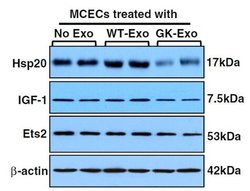 Invitrogen ETS2 Monoclonal Antibody (OTI1H4) 100 &mu;L | Buy Online | Invitrogen&trade; | Fisher Scientific