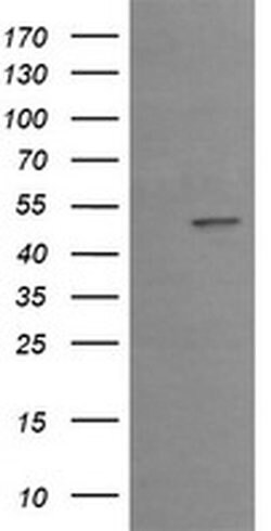 Invitrogen EGR2 Monoclonal Antibody (OTI1B12) 100 &mu;L; Unconjugated:Antibodies,