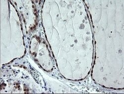 Invitrogen CMPK1 Monoclonal Antibody (OTI1A1) 100 &mu;L; Unconjugated:Antibodies,