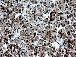 Invitrogen CMPK1 Monoclonal Antibody (OTI1A1) 100 &mu;L; Unconjugated:Antibodies,