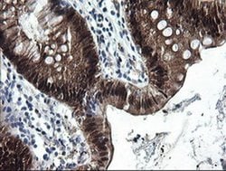 Invitrogen CMPK1 Monoclonal Antibody (OTI1A1) 100 &mu;L; Unconjugated:Antibodies,