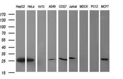 Invitrogen CMPK1 Monoclonal Antibody (OTI1A1) 100 &mu;L; Unconjugated:Antibodies,