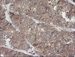 Invitrogen KappaB ras1 Monoclonal Antibody (OTI6C11) 100 &mu;L; Unconjugated:Antibodies,