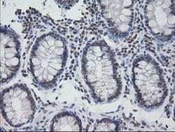 Invitrogen KappaB ras1 Monoclonal Antibody (OTI6C11) 100 &mu;L; Unconjugated:Antibodies,