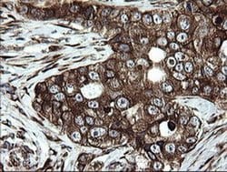 Invitrogen ARMC1 Monoclonal Antibody (OTI1D10) 100 &mu;L | Buy Online | Invitrogen&trade; | Fisher Scientific