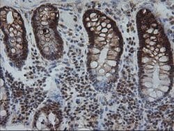 Invitrogen KIF25 Monoclonal Antibody (OTI2F4) 100 &mu;L; Unconjugated:Antibodies,