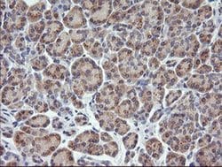 Invitrogen RhoJ Monoclonal Antibody (OTI2C10) 100 &mu;L; Unconjugated:Antibodies,