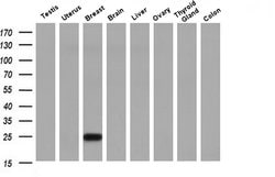 Invitrogen RhoJ Monoclonal Antibody (OTI2C10) 100 &mu;L; Unconjugated:Antibodies,