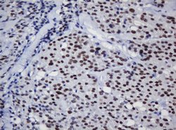 Invitrogen TRMT2A Monoclonal Antibody (OTI1G8) 100 &mu;L; Unconjugated:Antibodies,