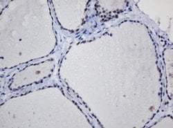 Invitrogen TRMT2A Monoclonal Antibody (OTI1G8) 100 &mu;L; Unconjugated:Antibodies,