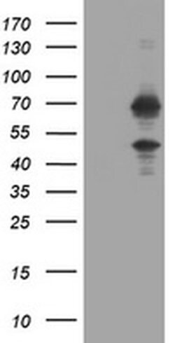 Invitrogen TRMT2A Monoclonal Antibody (OTI1G8) 100 &mu;L; Unconjugated:Antibodies,