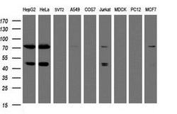 Invitrogen TRMT2A Monoclonal Antibody (OTI1G8) 100 &mu;L; Unconjugated:Antibodies,