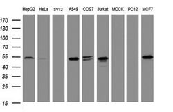 Invitrogen TAPBPL Monoclonal Antibody (OTI1C9) 100 &mu;L; Unconjugated:Antibodies,