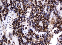 Invitrogen GLB1 Monoclonal Antibody (OTI1C9) 100 &mu;L; Unconjugated:Antibodies,