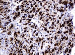 Invitrogen GLB1 Monoclonal Antibody (OTI1C9) 100 &mu;L; Unconjugated:Antibodies,