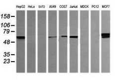 Invitrogen DIXDC1 Monoclonal Antibody (OTI6B6) 100 &mu;L; Unconjugated:Antibodies,