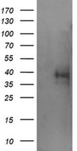 Invitrogen TRIM44 Monoclonal Antibody (OTI5C2) 100 &mu;L; Unconjugated:Antibodies,