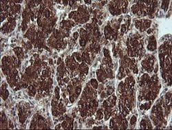 Invitrogen TRIM44 Monoclonal Antibody (OTI1E10) 100 &mu;L; Unconjugated:Antibodies,