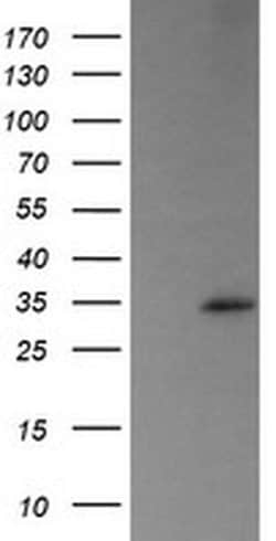 Invitrogen TRAPPC4 Monoclonal Antibody (OTI2E1) 100 &mu;L; Unconjugated:Antibodies,