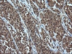 Invitrogen Alpha A Crystallin Monoclonal Antibody (OTI3B12) 100 &mu;L;