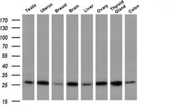 Invitrogen GBAS Monoclonal Antibody (OTI1B8) 100 &mu;L | Buy Online | Invitrogen&trade; | Fisher Scientific