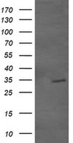 Invitrogen GBAS Monoclonal Antibody (OTI1B8) 100 &mu;L | Buy Online | Invitrogen&trade; | Fisher Scientific