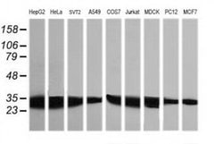 Invitrogen GBAS Monoclonal Antibody (OTI1B8) 100 &mu;L | Buy Online | Invitrogen&trade; | Fisher Scientific
