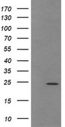 Invitrogen TRAPPC4 Monoclonal Antibody (OTI2G8) 100 &mu;L; Unconjugated:Antibodies,