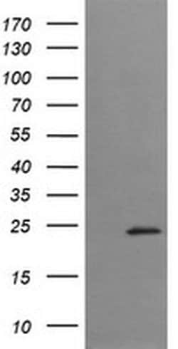 Invitrogen TRAPPC4 Monoclonal Antibody (OTI4C3) 100 &mu;L; Unconjugated:Antibodies,