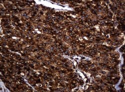 Invitrogen POGK Monoclonal Antibody (OTI6D5) 100 &mu;L; Unconjugated:Antibodies,
