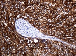 Invitrogen POGK Monoclonal Antibody (OTI6D5) 100 &mu;L; Unconjugated:Antibodies,