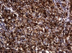 Invitrogen POGK Monoclonal Antibody (OTI6D5) 100 &mu;L; Unconjugated:Antibodies,