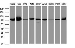 Invitrogen COG6 Monoclonal Antibody (OTI3C8) 100 &mu;L; Unconjugated:Antibodies,