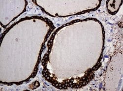 Invitrogen POGK Monoclonal Antibody (OTI3E2) 100 &mu;L; Unconjugated:Antibodies,