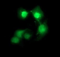 Invitrogen CDC123 Monoclonal Antibody (OTI1F8) 100 &mu;L; Unconjugated:Antibodies,