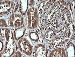 Invitrogen CDC123 Monoclonal Antibody (OTI1F8) 100 &mu;L; Unconjugated:Antibodies,