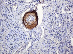 Invitrogen PARVB Monoclonal Antibody (OTI1B7) 100 &mu;L; Unconjugated:Antibodies,