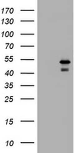 Invitrogen PARVB Monoclonal Antibody (OTI1B7) 100 &mu;L; Unconjugated:Antibodies,