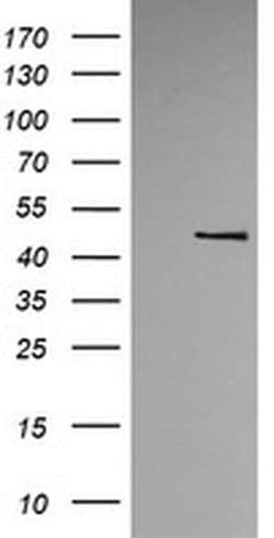 Invitrogen TRMU Monoclonal Antibody (OTI2A4) 100 &mu;L; Unconjugated:Antibodies,