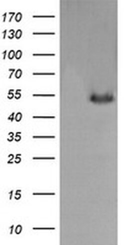 Invitrogen MDMX Monoclonal Antibody (OTI4G5) 100 &mu;L | Buy Online | Invitrogen&trade; | Fisher Scientific