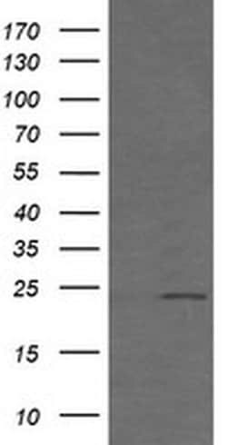 Invitrogen RAB21 Monoclonal Antibody (OTI6E12) 100 &mu;L; Unconjugated:Antibodies,