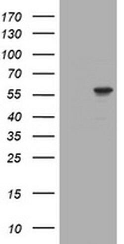 Invitrogen RNF23 Monoclonal Antibody (OTI2A6) 100 &mu;L; Unconjugated:Antibodies,