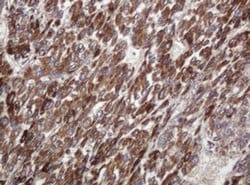 Invitrogen TBC1D13 Monoclonal Antibody (OTI2C5) 100 &mu;L; Unconjugated:Antibodies,