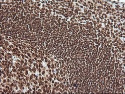 Invitrogen MAPK4 Monoclonal Antibody (OTI2D7) 100 &mu;L; Unconjugated:Antibodies,
