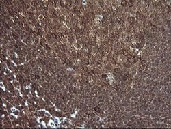 Invitrogen PIK3R5 Monoclonal Antibody (OTI5B1) 100 &mu;L; Unconjugated:Antibodies,