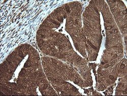 Invitrogen PIK3R5 Monoclonal Antibody (OTI5B1) 100 &mu;L; Unconjugated:Antibodies,