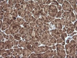 Invitrogen PIK3R5 Monoclonal Antibody (OTI5B1) 100 &mu;L; Unconjugated:Antibodies,
